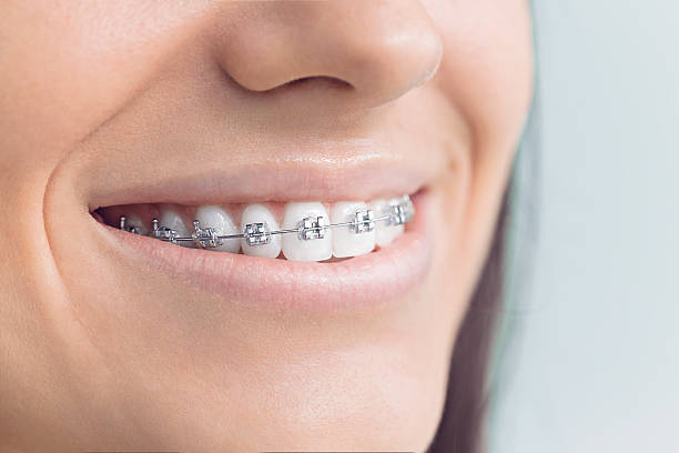 Best Dental Fillings (Composite and Amalgam)  in Pine Ridge At Crestwood, NJ